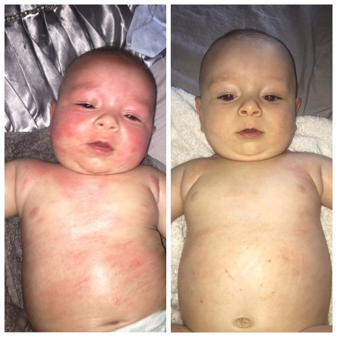 Kokoso Baby Kokosový olej výsledky_4
